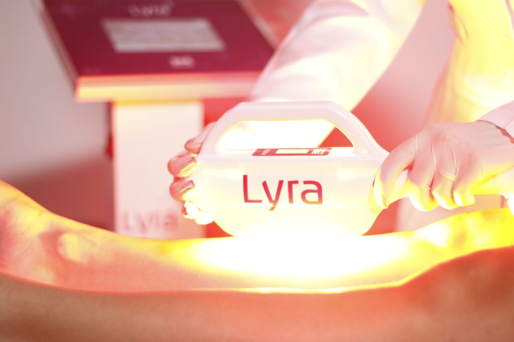 Epilação com Luz Intensa Pulsada IBRAMED Lyra