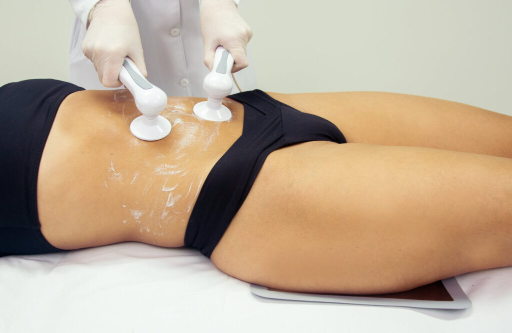 Imagem apresentando a aplicação do Nèartek para tratamentos de gordura localizada e de modelagem corporal.