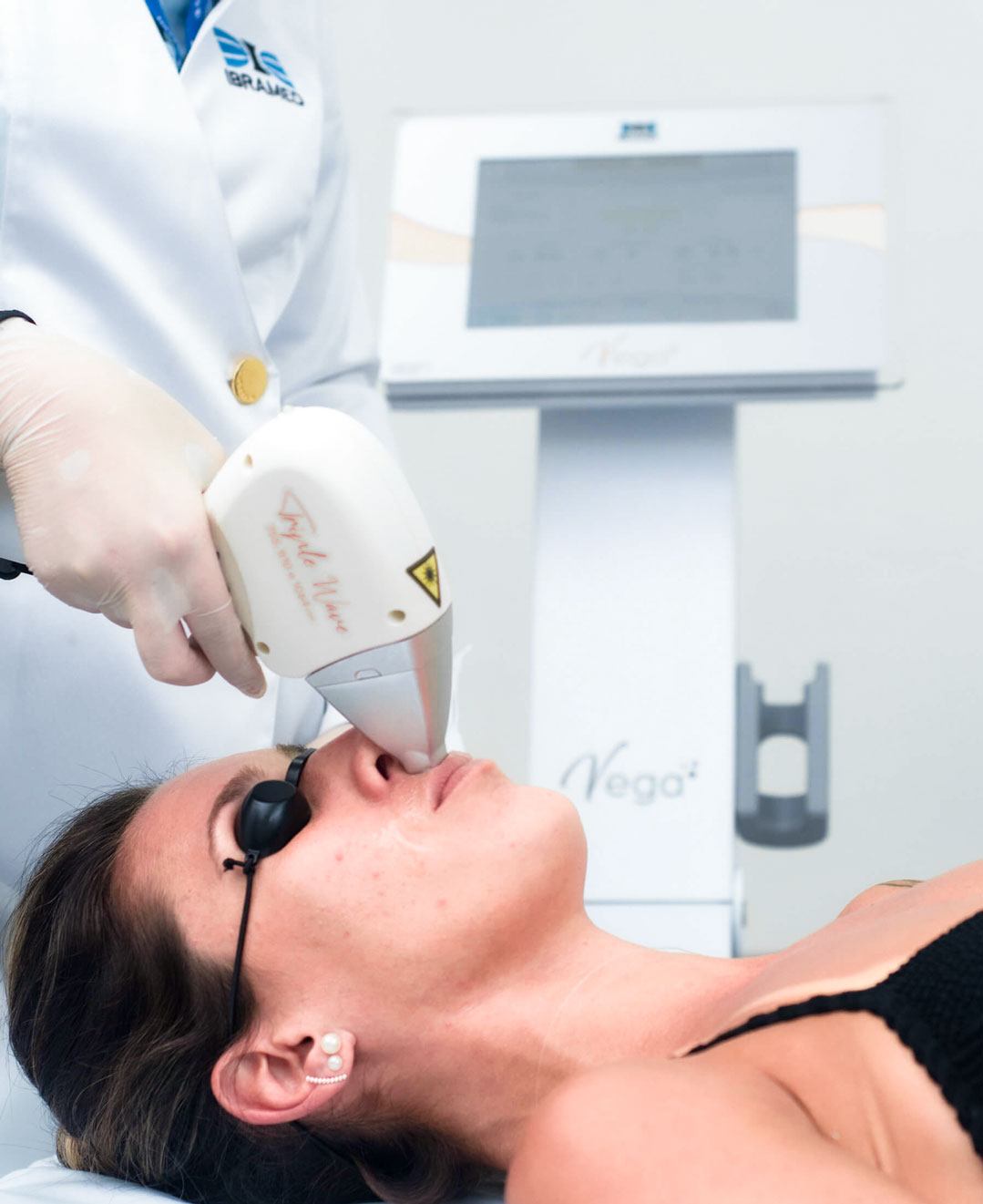 Vega Laser de epilação