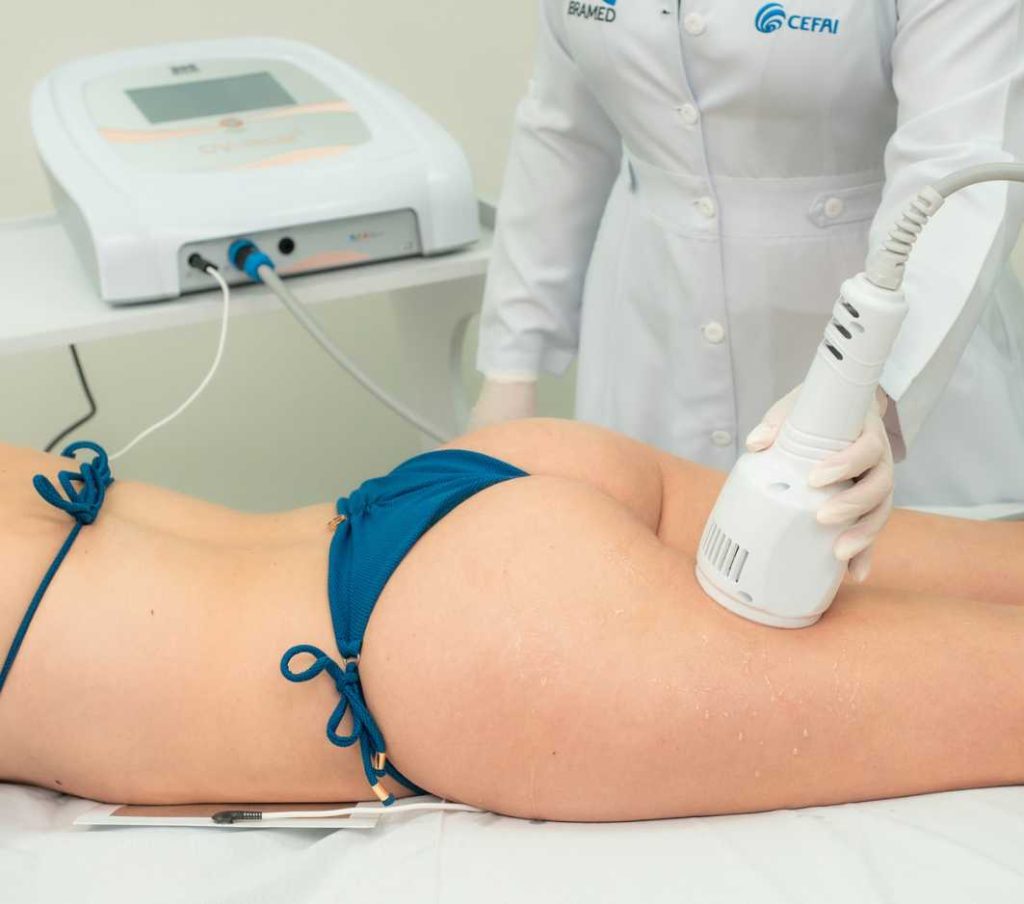 Cryotecar Ibramed