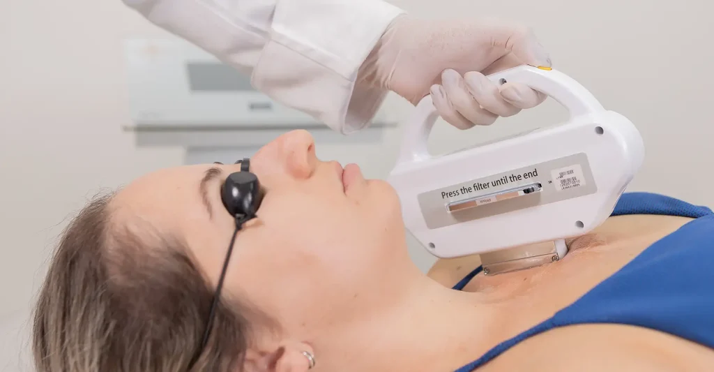 Luz Intensa Pulsada Ibramed Lyra tratamento de manchas