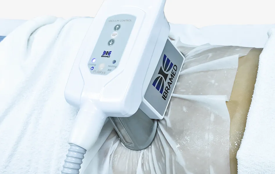 Criolipólise de Preparo - Polarys IBRAMED