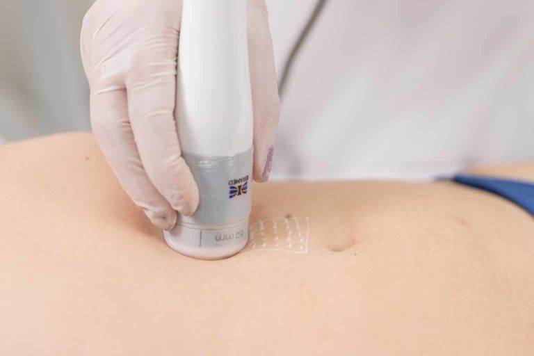 Ultrassom Microfocado IBRAMED Sonofocus - Guia Completo