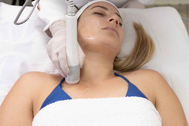 Ultrassom Microfocado Sonofocus IBRAMED - Tratamentos estético facial e corporal - Tendências na estética 2025