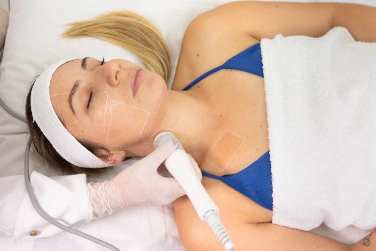 Tratamento Full Face com Ultrassom Microfocado - Sonofocus IBRAMED