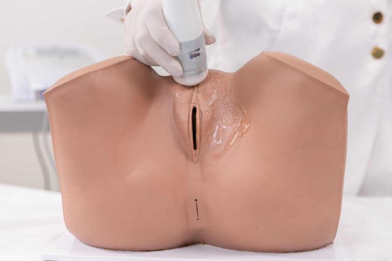 Ultrassom Microfocado para Estética íntima - Rejuvenescimento intimo - estética