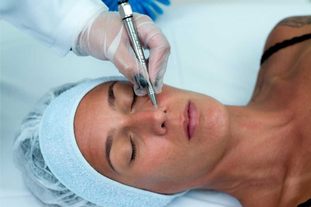 Vacuoterapia para limpeza de pele - Estética - IBRAMED