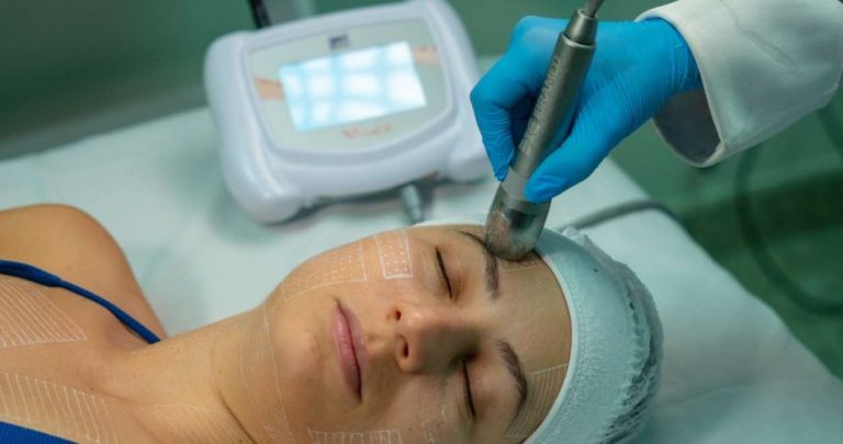 Ultrassom Microfocado Visage para Harmonização Facial