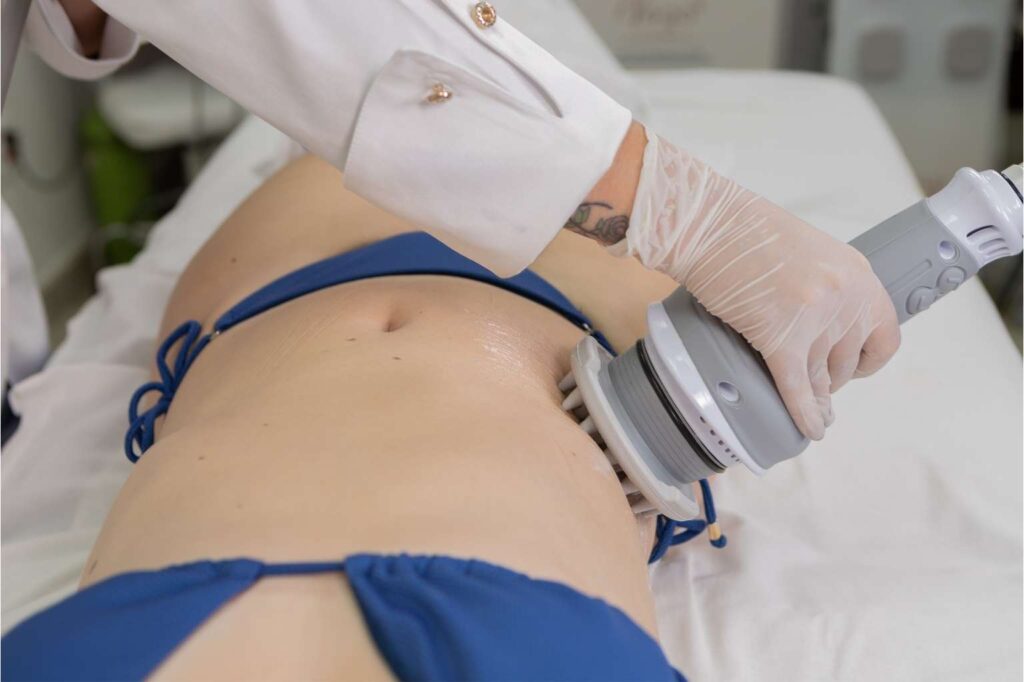 Modellata Ibramed - Estética Corporal