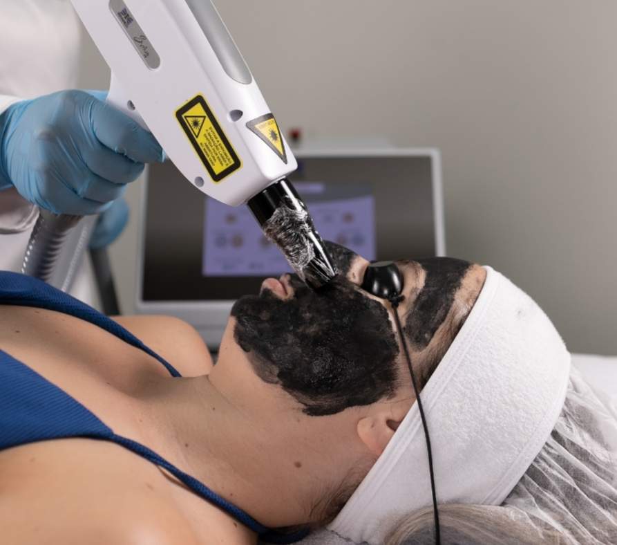 Black Peel - Peeling de Hollywood para Rejuvenescimento