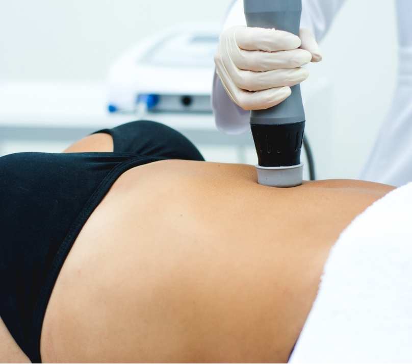 Ondas de Choque para estética com Thork da Ibramed