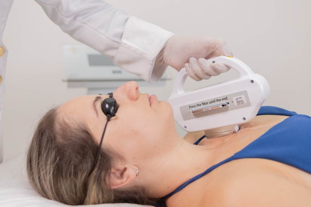 Luz Intensa Pulsada com o Lyra para Manchas e Rejuvenescimento