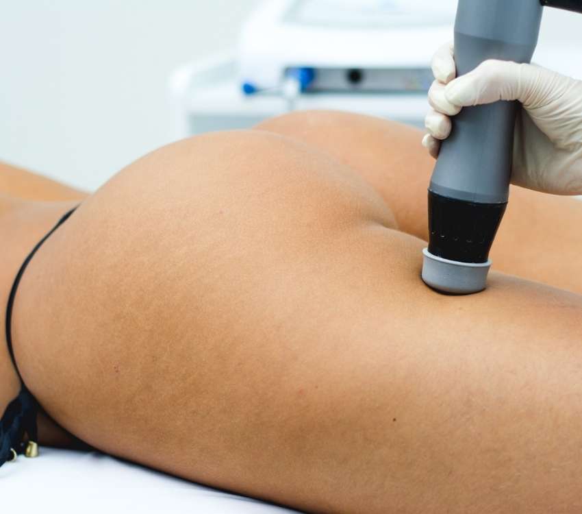 Ondas de Choque para Celulite - Thork Ibramed