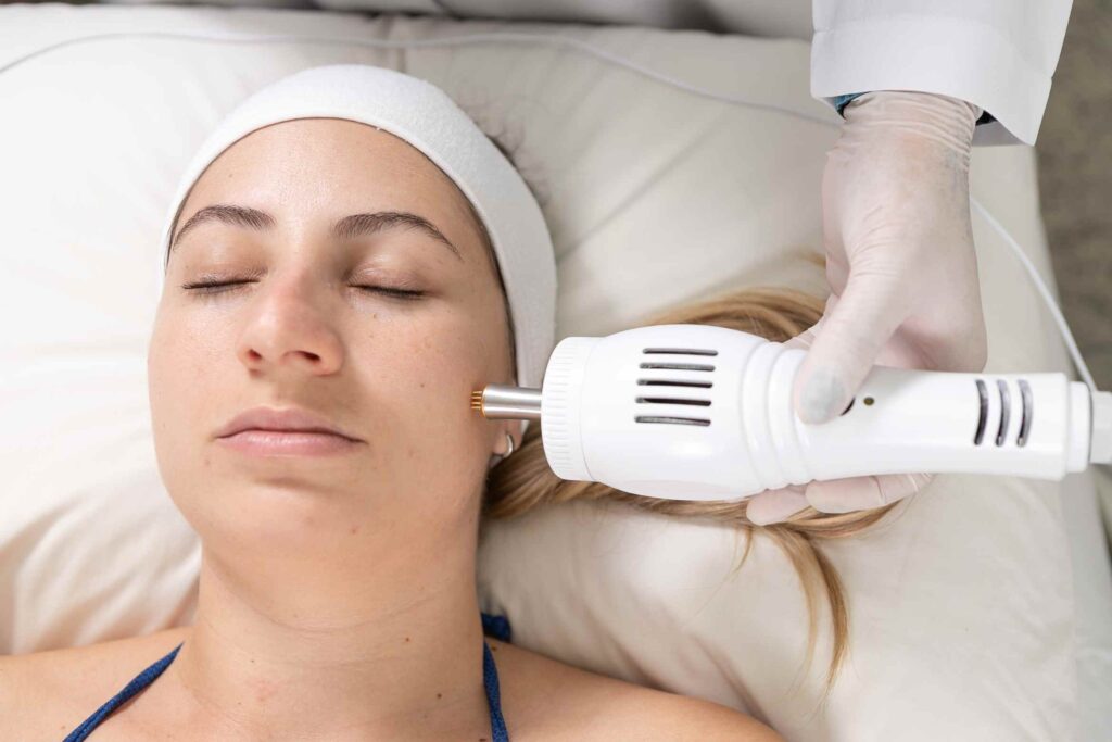 Radiofrequência Fracionada sem agulhas para harmonização orofacial