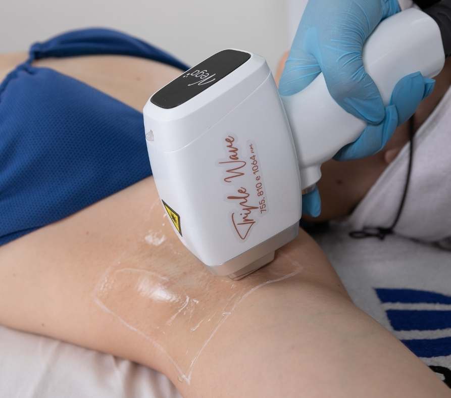 Epilação a laser: resultados comprovados na remoção dos pelos