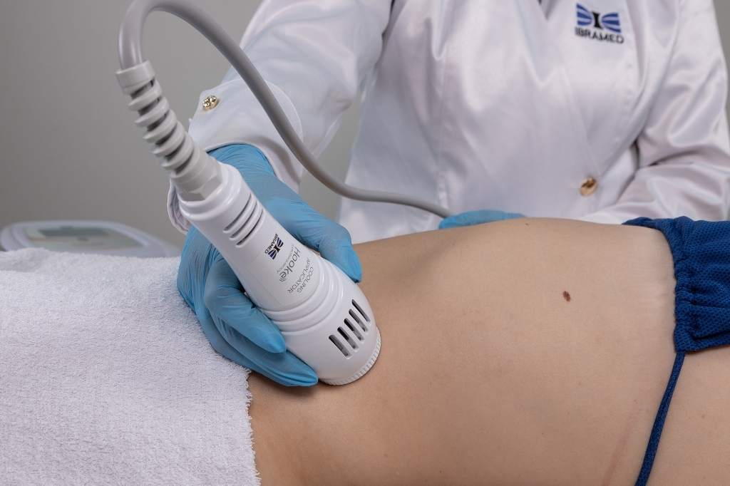 Radiofrequência para Flacidez pós canetas emagrecedoras