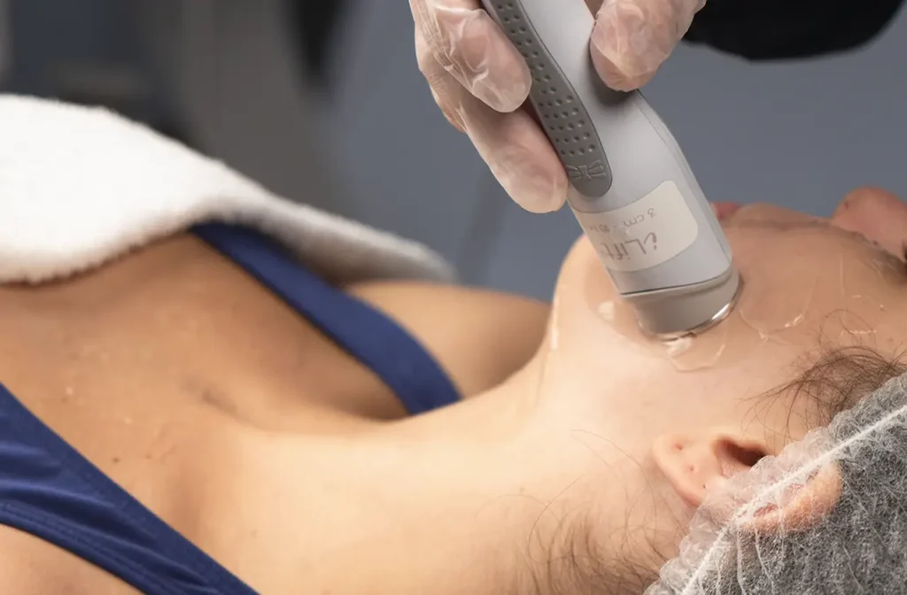 Ultrassom Terapêutico facial iLift 5mhz e 10mhz
