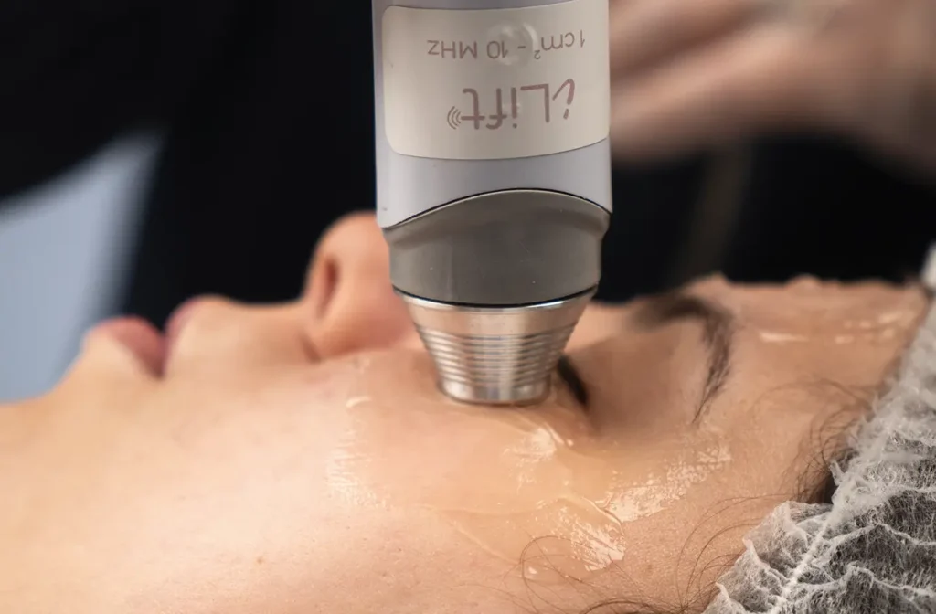 Ultrassom Terapêutico Facial de 10MHz na olheira - iLift Ibramed