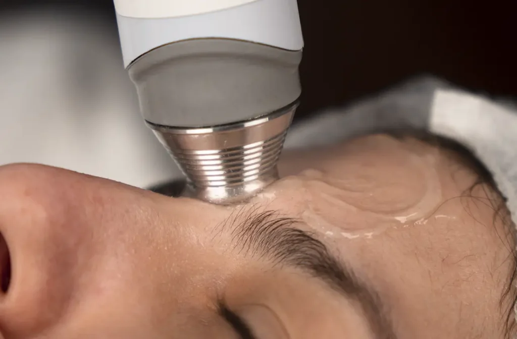 Ultrassom Terapêutico Facial de 10MHz