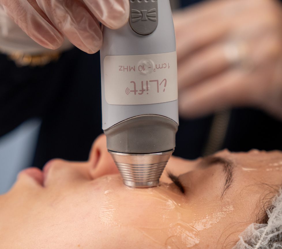 Ultrassom Terapêutico Facial de 5mhz e 10mhz
