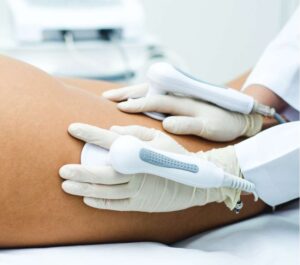 Tecarterapia e Radiofrequência no Nèartek