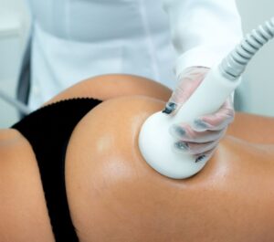 Terapia combinada: Radiofrequência associado a Vacuoterapia com o Dermotonus Esthetic