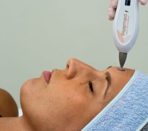 Jato de Plasma para rejuvenescimento facial