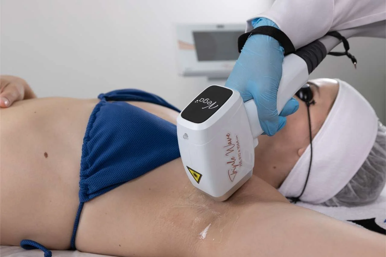 Laser Triple Wave Vega - Laser de epilação