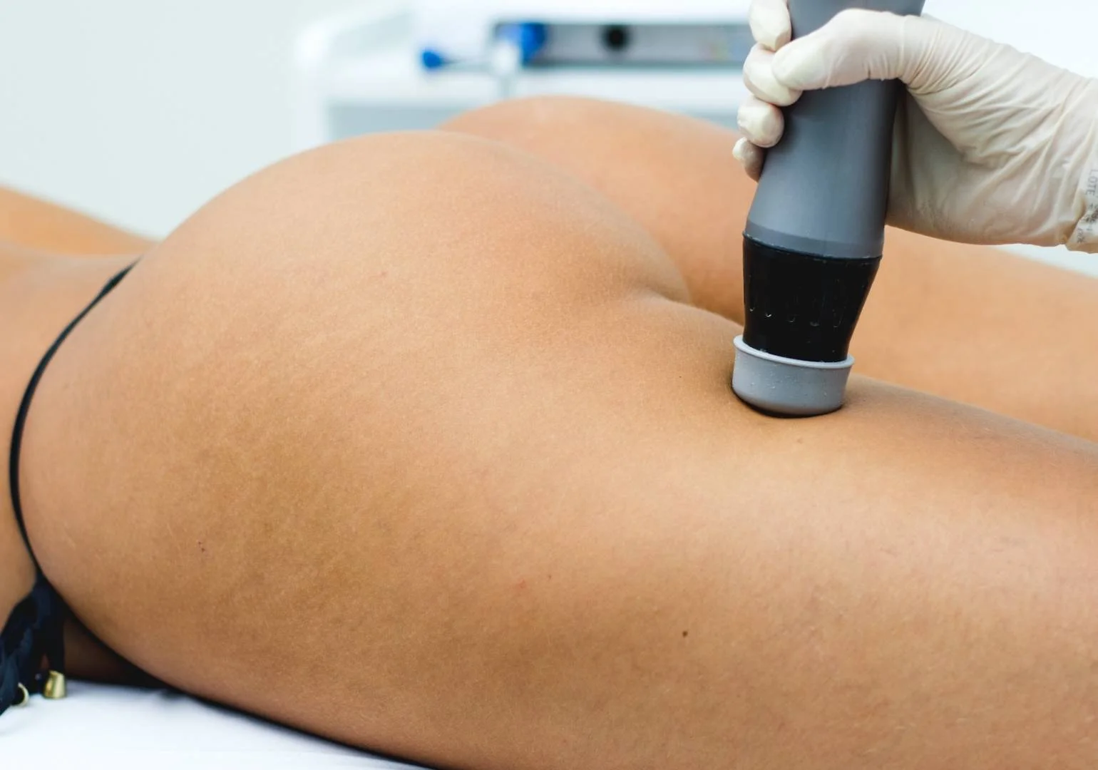 Ondas de Choque no tratamento de lipedema