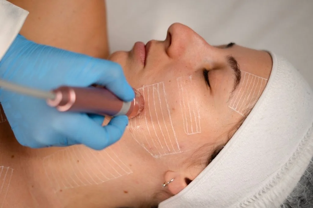 Ultrassom Microfocado para rejuvenescimento associado a injetável