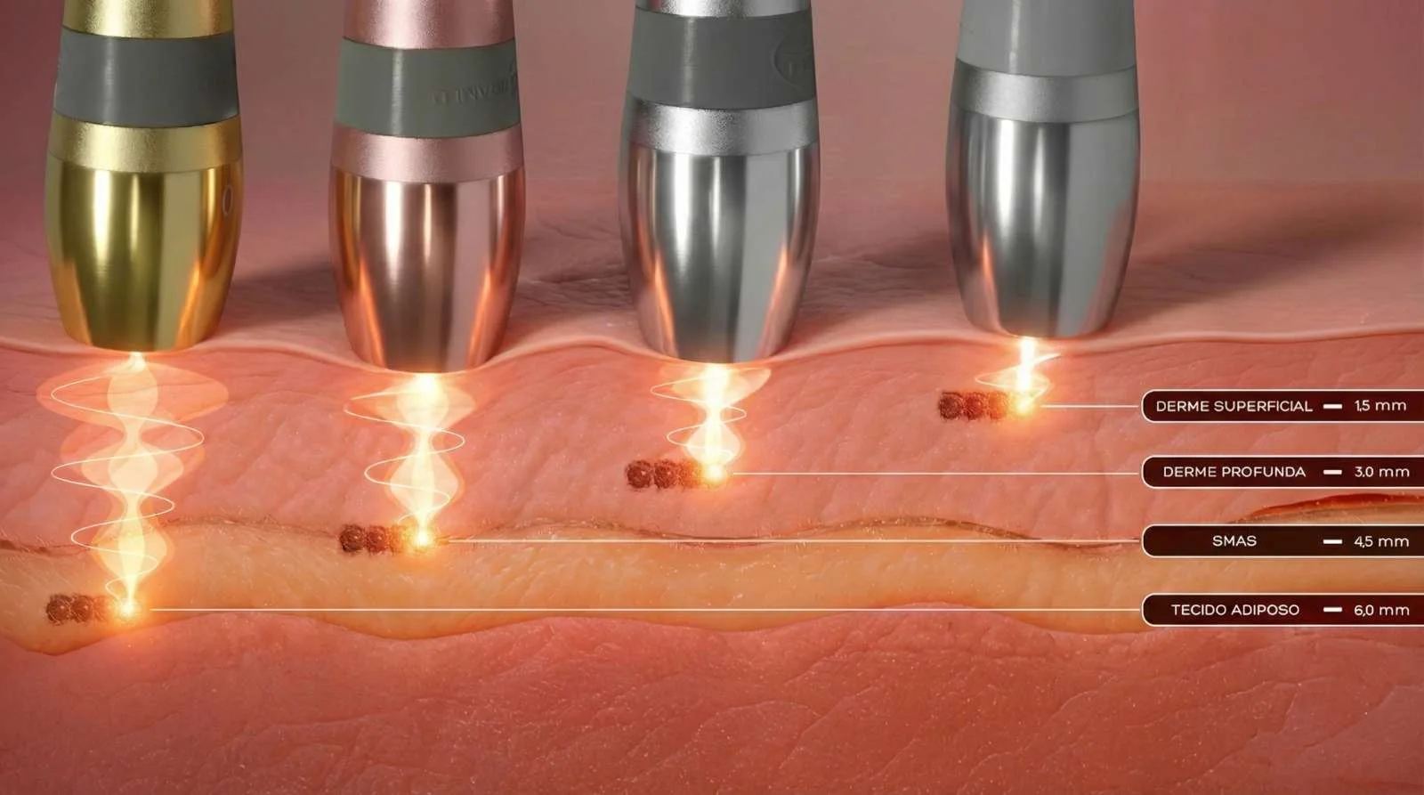 Ultrassom Microfocado Visage Fisiologia - Ibramed